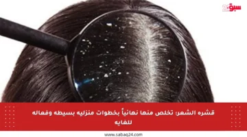 قشرة الشعر: تخلص منها نهائياً بخطوات منزلية بسيطة وفعالة للغاية
